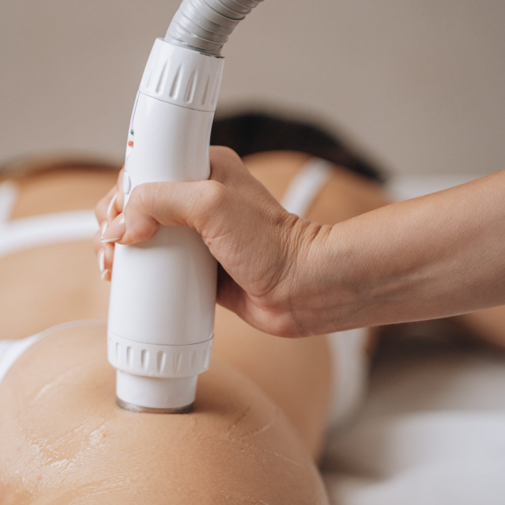 Tratamiento de reafirmación con máquina de radiofrecuencia corporal en glúteos.
