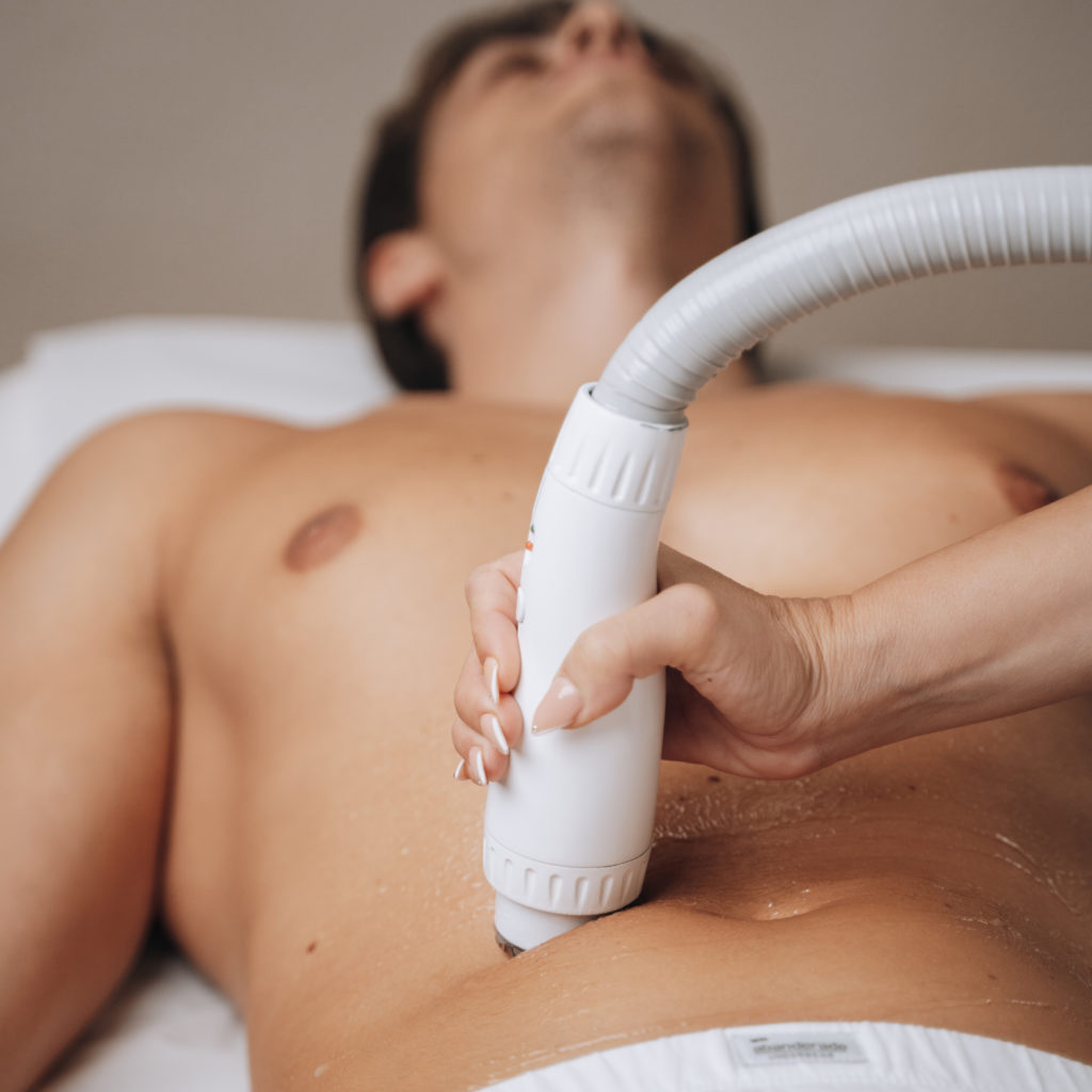 Máquina de radiofrecuencia de Adermica siendo utilizada sobre el abdomen de un hombre.